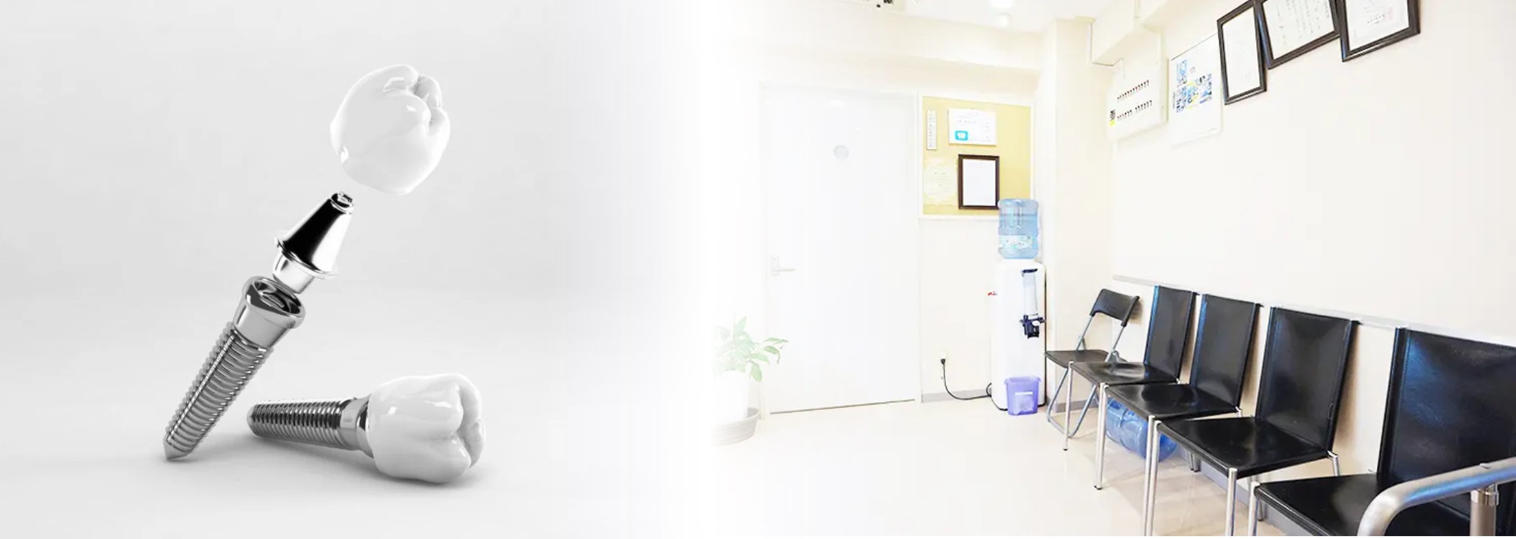 元住吉（川崎市中原区）のインプラント専門外来、よしだ・ファミリー・歯科は安心の10年保証