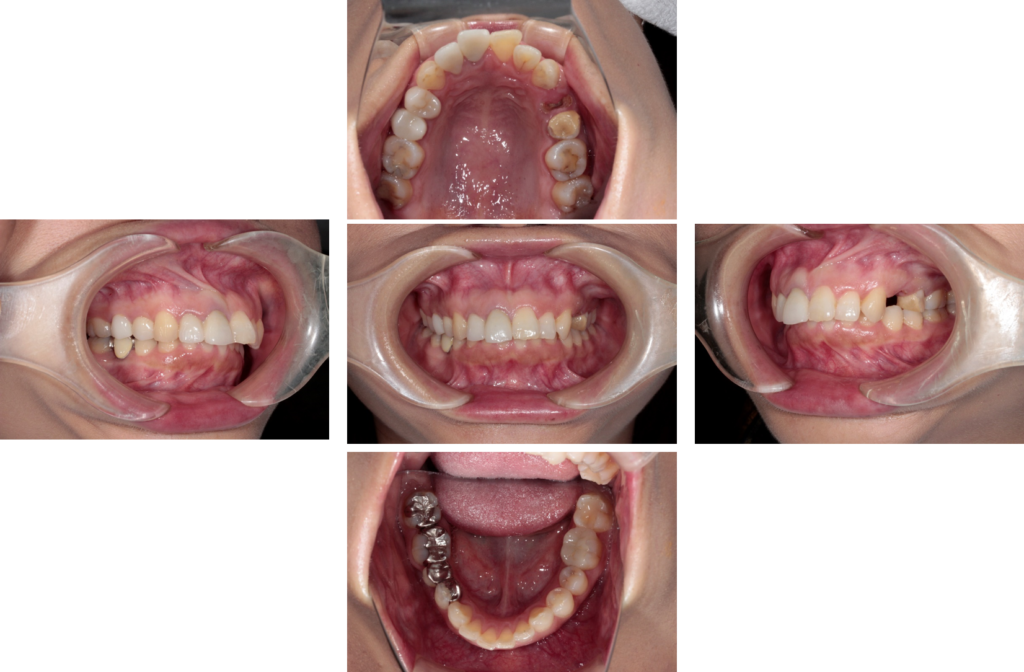 cace03-1-1024x672.png